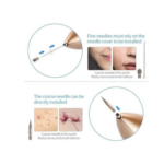 Cauterizador Recargable Quita Verrugas - 303989
