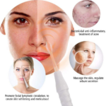 Alta Frecuencia Facial 4 Electrodos - 62328
