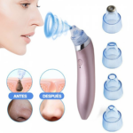 Limpiador Facial extractor de espinilla - 722566